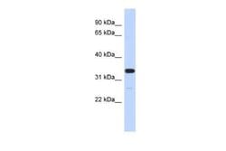 FAM76A Rabbit anti-Human, Polyclonal, Novus Biologicals 100 &mu;g | Buy Online | Novus Biologicals | Fisher Scientific